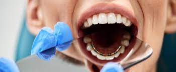 Professional Dental Team